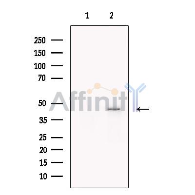 TIM 4 Antibody - Western blot analysis of extracts from Jurkat, using TIM 4 Antibody.