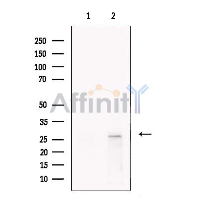 SOX14 Antibody - Western blot analysis of extracts from HepG2 cells, using SOX14 Antibody.