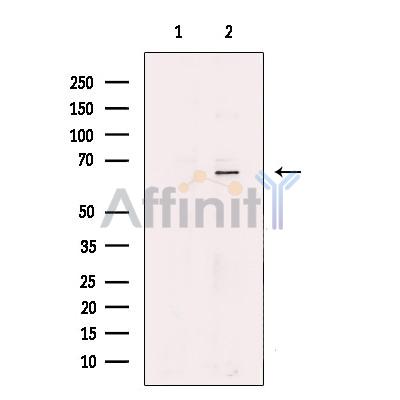 GLUT12 Antibody - Western blot analysis of extracts from Human  liver, using GLUT12 Antibody.