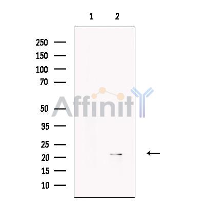 Apolipoprotein M Antibody - Western blot analysis of extracts from Human  Plasma, using Apolipoprotein M Antibody.