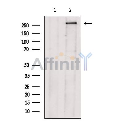 TACC2 Antibody - Western blot analysis of extracts from HepG2 cells, using TACC2 Antibody.