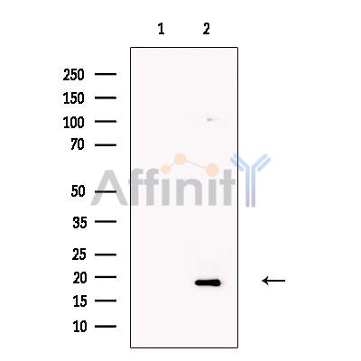 Olfactory Marker Protein Antibody - Western blot analysis of extracts from HepG2 cells, using Olfactory Marker Protein Antibody.