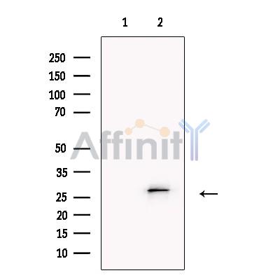 TMEM109 Antibody - Western blot analysis of extracts from U251 MG, using TMEM109 Antibody.