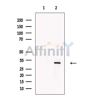 EB3 Antibody - Western blot analysis of extracts from Mouse  brain, using EB3 Antibody.