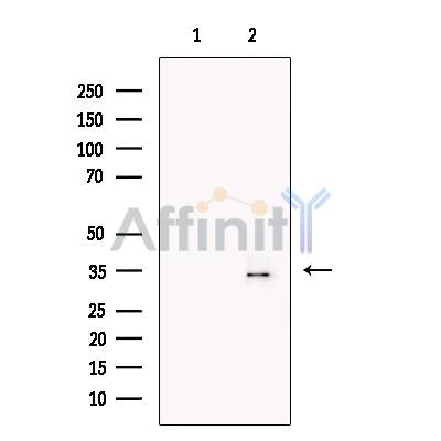 HOXA4 Antibody - Western blot analysis of extracts from SW620, using HOXA4 Antibody.