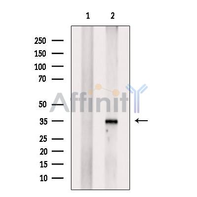 HOXA4 Antibody - Western blot analysis of extracts from DU145 cells, using HOXA4 Antibody.
