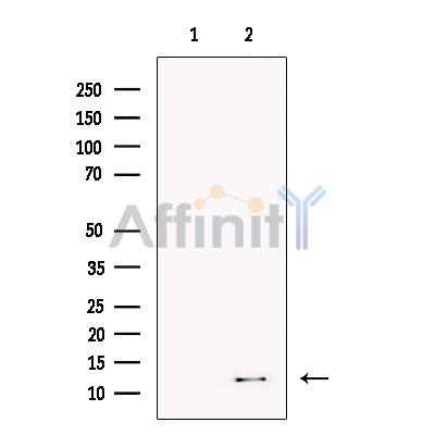 Kappa light chain Antibody - Western blot analysis of extracts from Human  tonsil, using Kappa light chain Antibody.