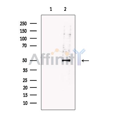SPRED2 Antibody - Western blot analysis of extracts from 293T, using SPRED2 Antibody.