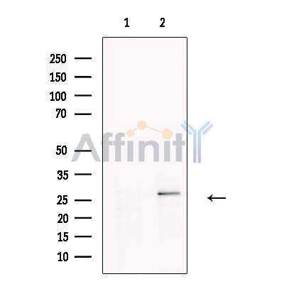 DERL2 Antibody - Western blot analysis of extracts from Human  lymph node, using DERL2 Antibody.