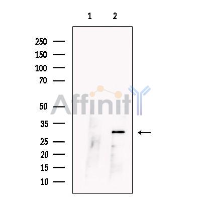CCDC28A Antibody - Western blot analysis of extracts from Human  oral muCOSa, using CCDC28A Antibody.