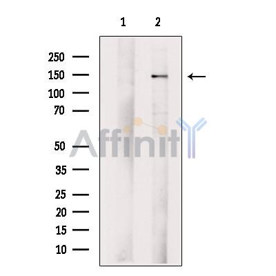 SCAP Antibody - Western blot analysis of extracts from B16F10 cells, using SCAP Antibody.