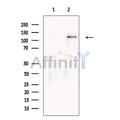 FHOD1 Antibody - Western blot analysis of extracts from Hela cells, using FHOD1 Antibody.
