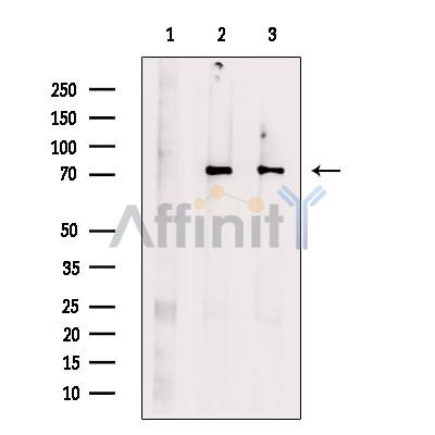 Methylmalonyl Coenzyme A mutase Antibody - Western blot analysis of extracts from various samples, using Methylmalonyl Coenzyme A mutase Antibody.