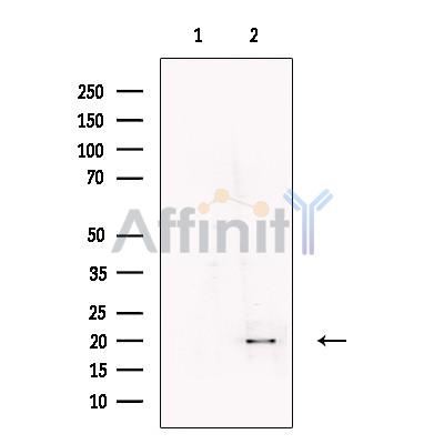 UXT Antibody - Western blot analysis of extracts from Human  adrenal gland, using UXT Antibody.