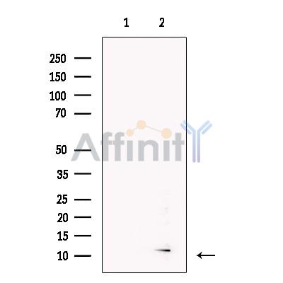 BAGE2 Antibody - Western blot analysis of extracts from Human  testis, using BAGE2 Antibody.