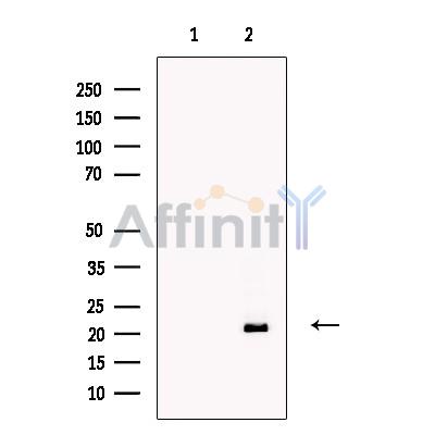 AMELX Antibody - Western blot analysis of extracts from Jurkat, using AMELX Antibody.