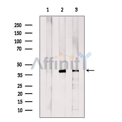 SCAMP2 Antibody - Western blot analysis of extracts from various samples, using SCAMP2 Antibody.