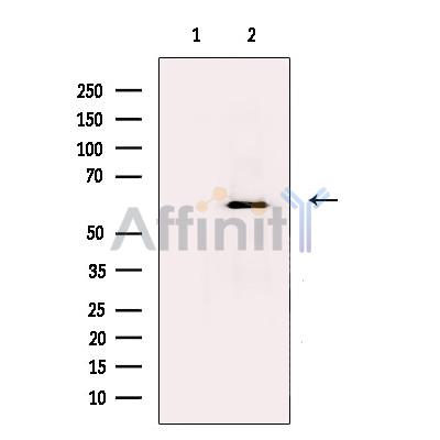 FLIP Antibody - Western blot analysis of extracts from K562, using FLIP delta + gamma Antibody.