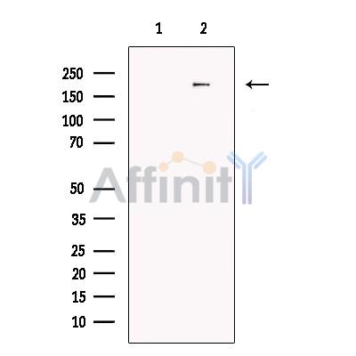 FKBP135 Antibody - Western blot analysis of extracts from Hela cells, using FKBP135 Antibody.