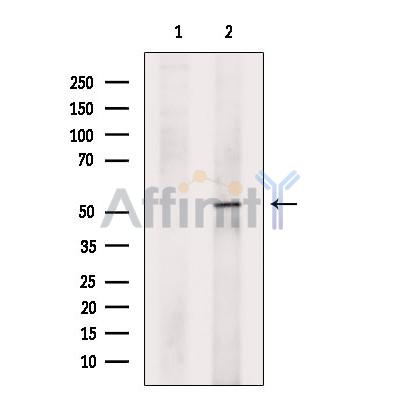 SEC61A Antibody - Western blot analysis of extracts from VERO cells, using SEC61A Antibody.