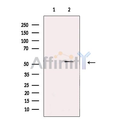 SEC61A Antibody - Western blot analysis of extracts from Rat  brain, using SEC61A Antibody.