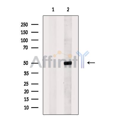 ECSIT Antibody - Western blot analysis of extracts from Mouse  testis, using ECSIT Antibody.