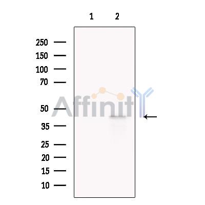 LHX6 Antibody - Western blot analysis of extracts from HepG2 cells, using LHX6 Antibody.