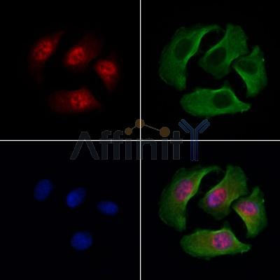 SATB2 Antibody - DF2962 staining Hela cells by IF/ICC.