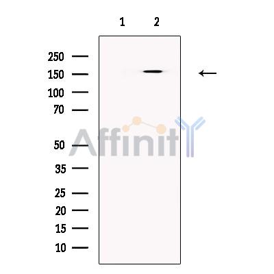 ATP7B Antibody - Western blot analysis of extracts from HepG2 cells, using ATP7B Antibody.