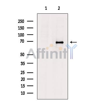 EPN3 Antibody - Western blot analysis of extracts from DU145 cells, using EPN3 Antibody.