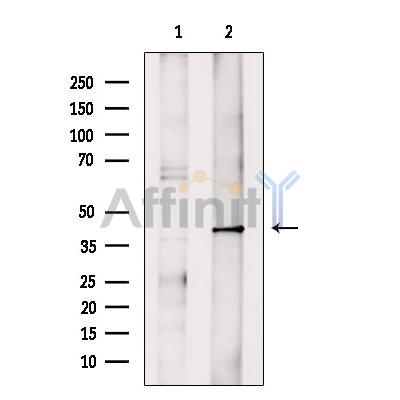 GJA4 Antibody - Western blot analysis of extracts from B16F10 cells, using GJA4 Antibody.