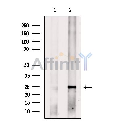 MED18 Antibody - Western blot analysis of extracts from DU145 cells, using MED18 Antibody.