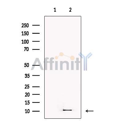 S100A3 Antibody - Western blot analysis of extracts from OVCAR3, using S100A3 Antibody.