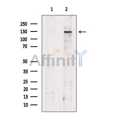 SFRS15 Antibody - Western blot analysis of extracts from Rat  liver, using SFRS15 Antibody.