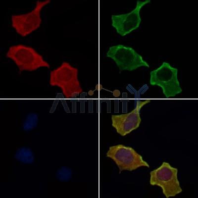 THBD Antibody - DF4565 staining Hela cells by IF/ICC.