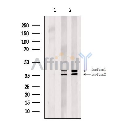 GTF3A Antibody - Western blot analysis of extracts from various samples, using GTF3A Antibody.