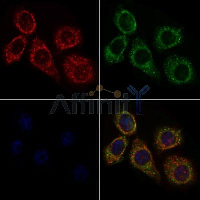 UBE2D2 Antibody - DF4600 staining HepG2 cells by IF/ICC.