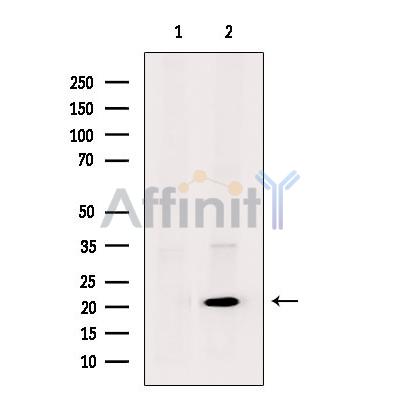 UBE2T Antibody - Western blot analysis of extracts from A2780 cells, using UBE2T Antibody.