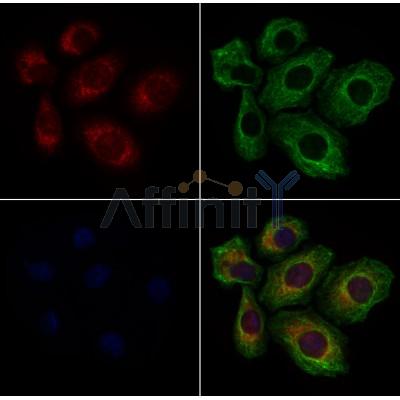 CLTR2 Antibody - DF4917 staining Hela cells by IF/ICC.
