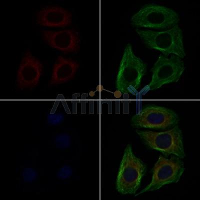 CSRL1 Antibody - DF4919 staining Hela cells by IF/ICC.