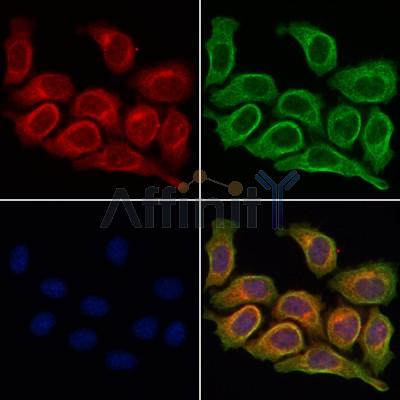 ETBR2 Antibody - DF4926 staining Hela cells by IF/ICC.