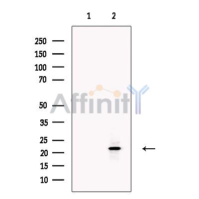 Rac1/cdc42 Antibody - Western blot analysis of extracts from Hela cells, using CDC42 Antibody.