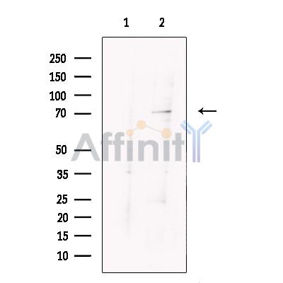 ARHGAP25 Antibody - Western blot analysis of extracts from Jurkat , using ARHGAP25 Antibody.