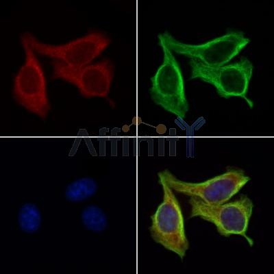 PRSS1 Antibody - DF6374 staining Hela cells by IF/ICC.