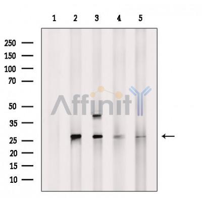 PSMA6 Antibody - Western blot analysis of extracts from various samples, using PSMA6 Antibody.