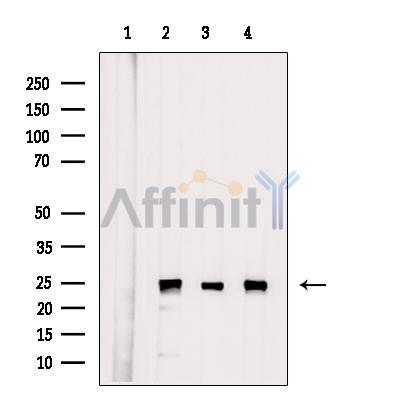PSMA2 Antibody - Western blot analysis of extracts from various samples, using PSMA2 Antibody.