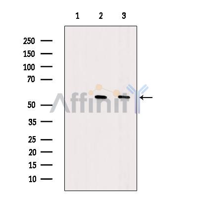 DKK3 Antibody - Western blot analysis of extracts from various samples, using DKK3 Antibody.