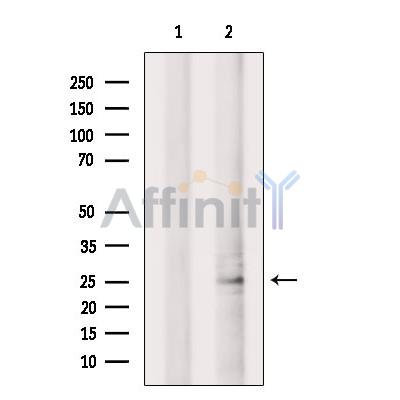 CLEC4D Antibody - Western blot analysis of extracts from EC304 cells, using CLEC4D Antibody.