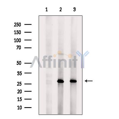 CLEC4A Antibody - Western blot analysis of extracts from various samples, using CLEC4A Antibody.