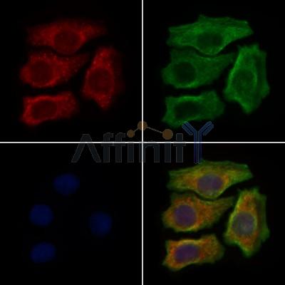 LAMP3 Antibody - DF7099 staining Hela cells by IF/ICC.